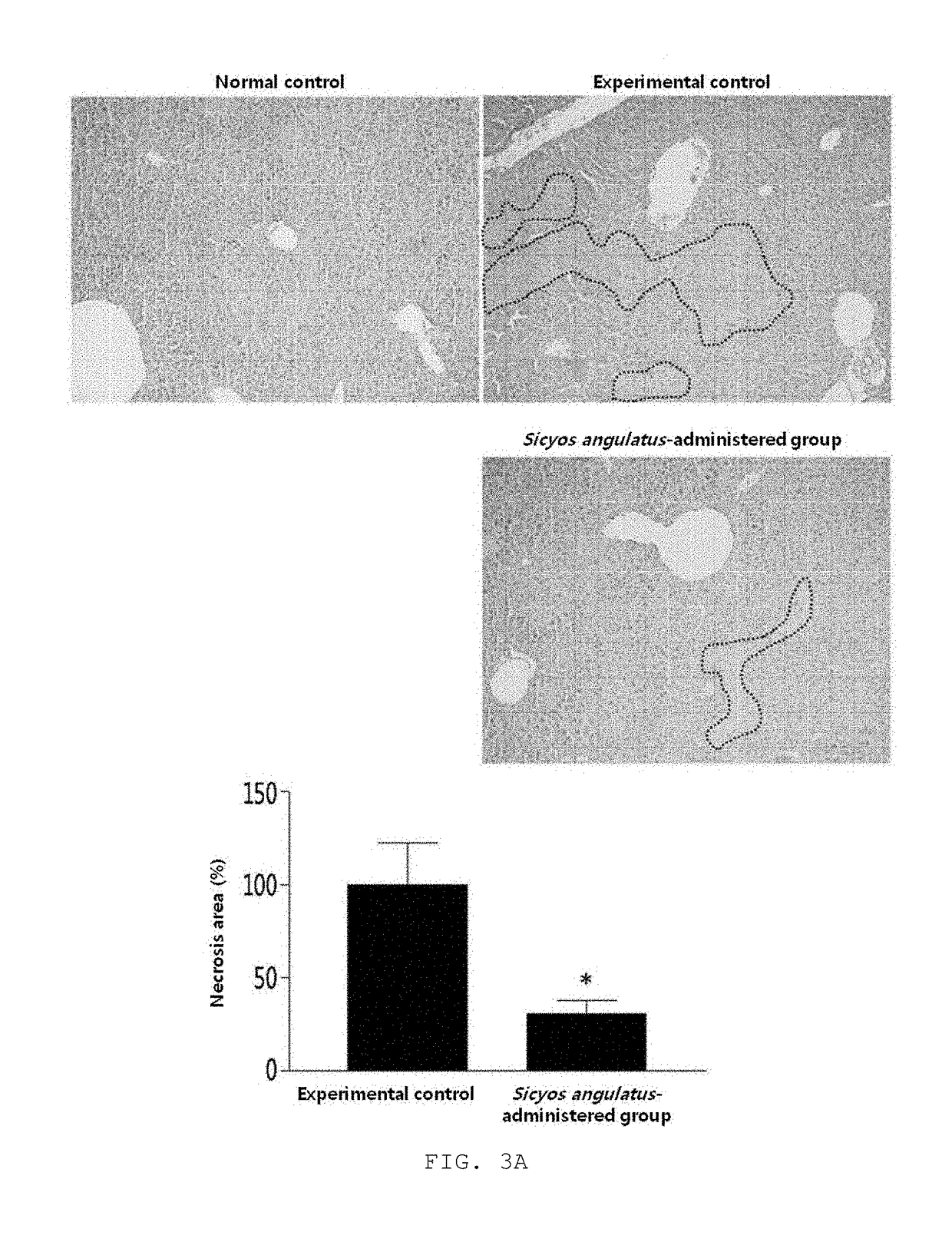 Composition for treating or preventing liver diseases, containing sicyos angulatus extract as active ingredient