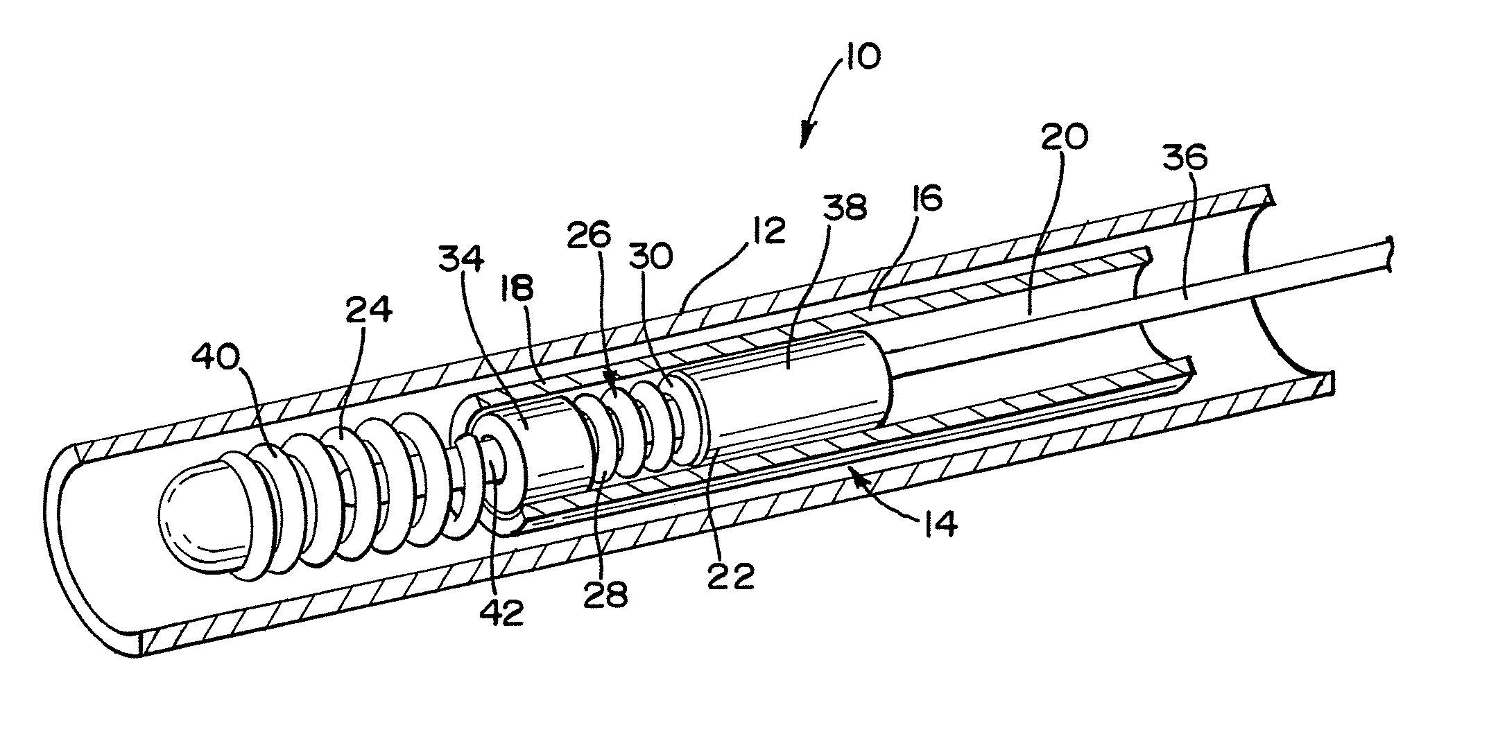 Embolic device delivery system