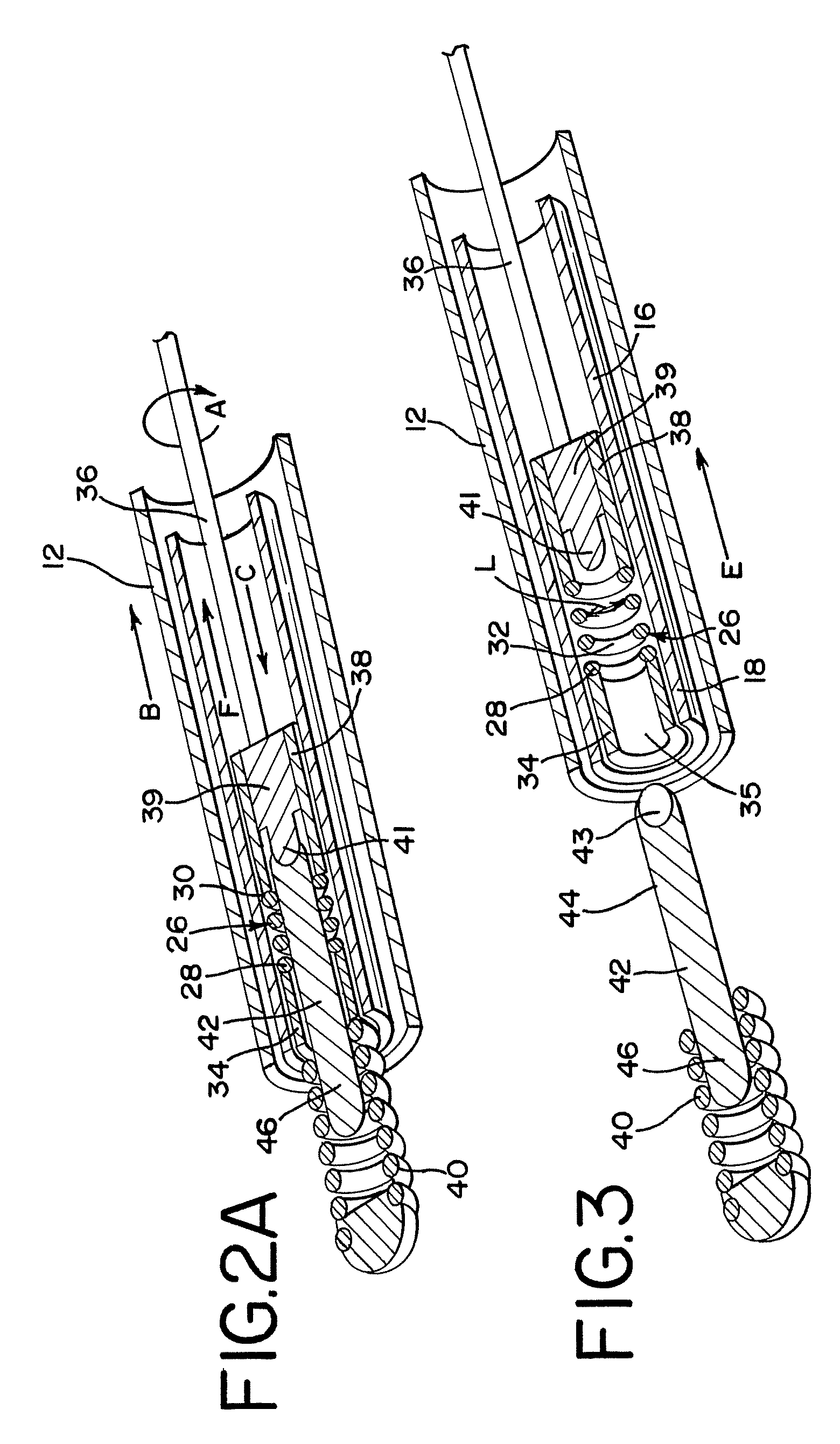 Embolic device delivery system