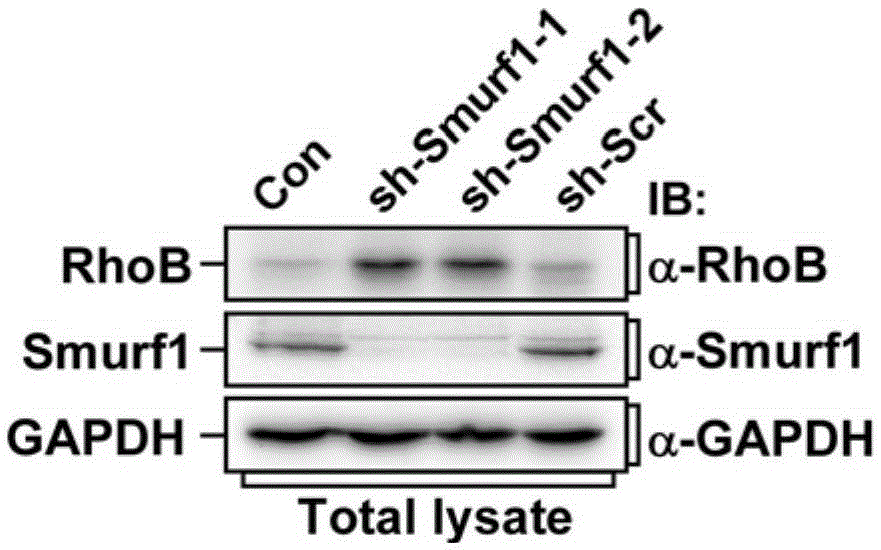 Screening method for anti-tumor drugs targeting Smurf1 ubiquitination and degradation of Rhob