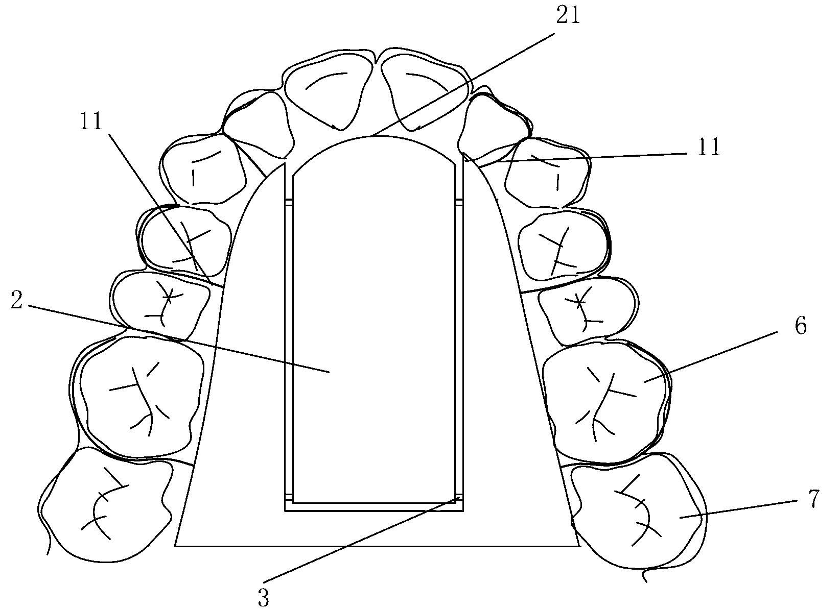 Functional snore guard