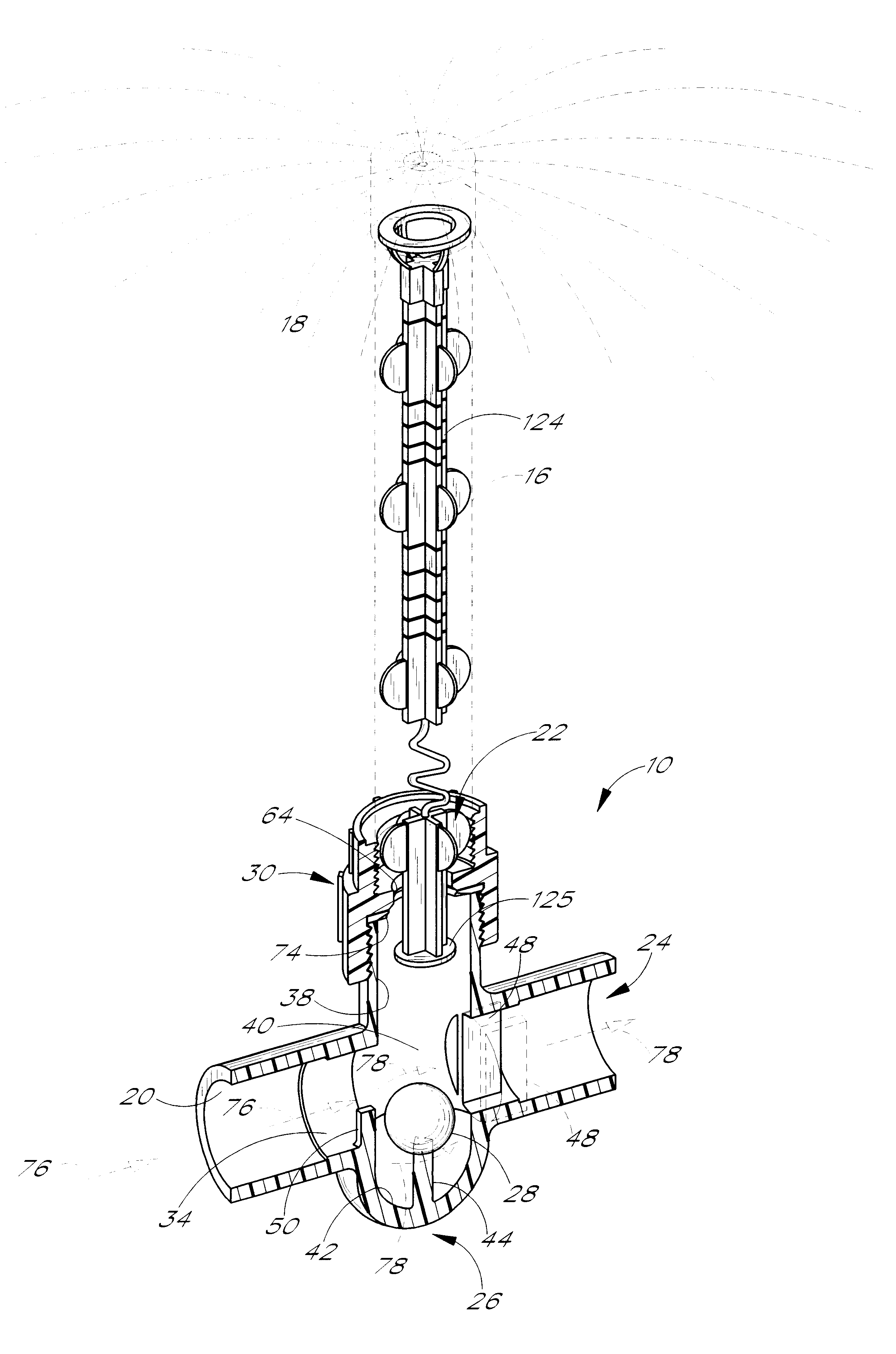 Fluid flow control valve