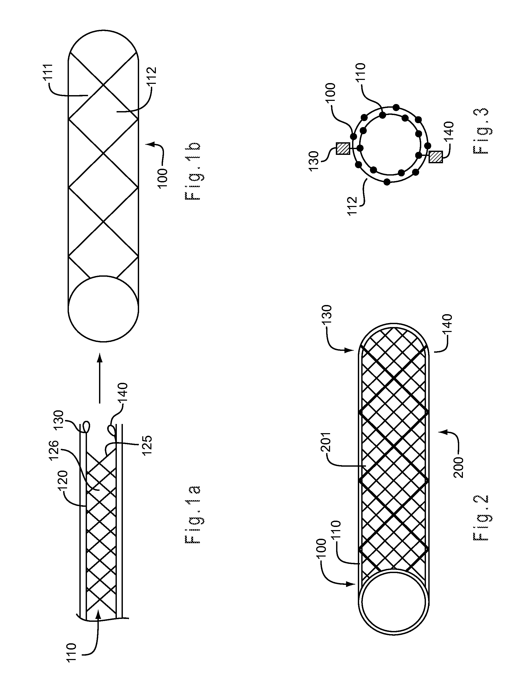 Stent-within-stent arrangements