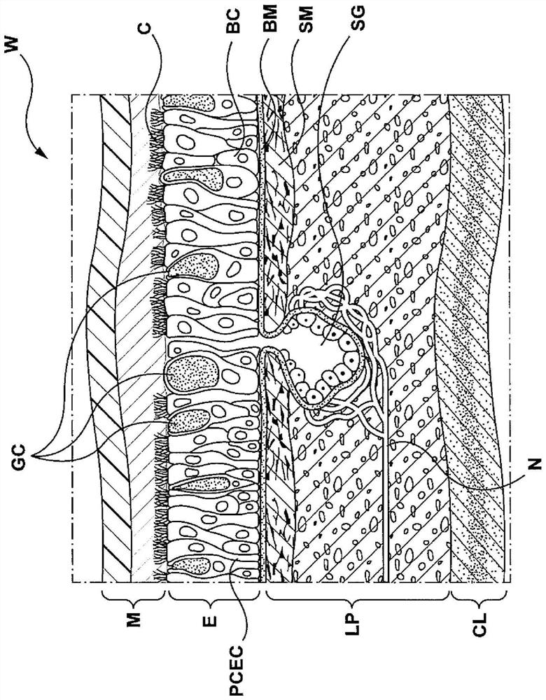 Methods, apparatuses, and systems for the treatment of disease states and disorders