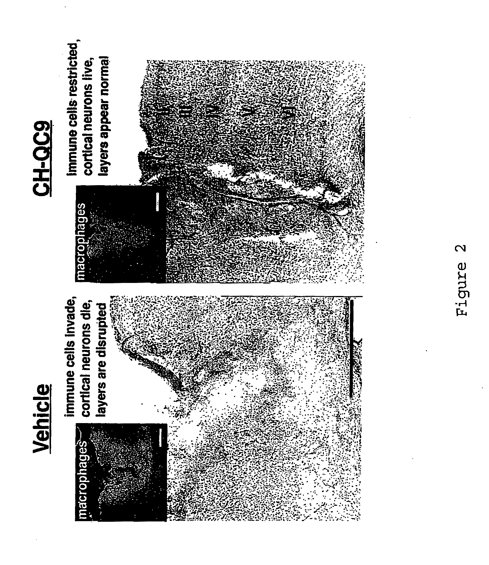 Small Survival-Promoting/Immunomodulatory Peptide for Treatment of Brain Damage, Neurodegenerative Disorders, and Inflammatory Disorders