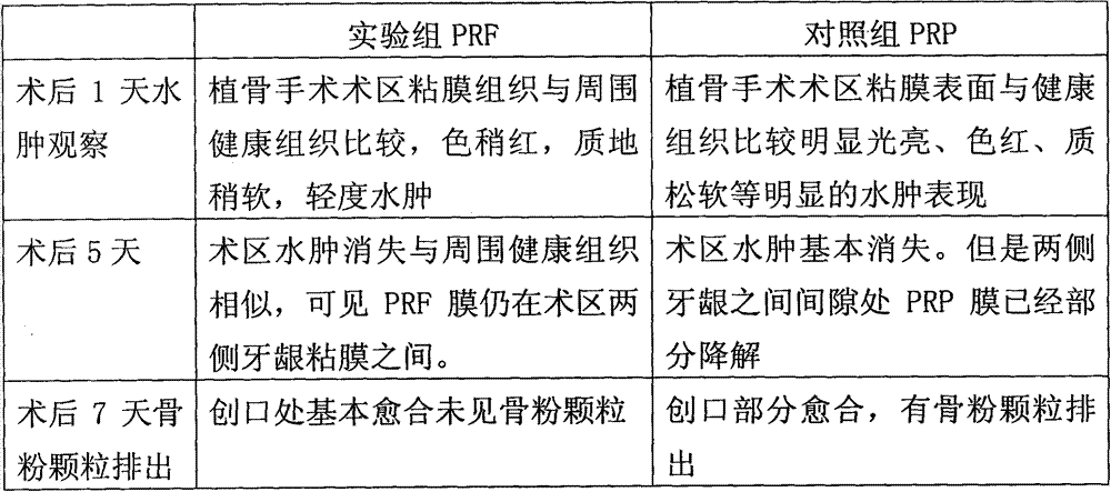 Implant material with PRF precursor liquid solidified into gel mask