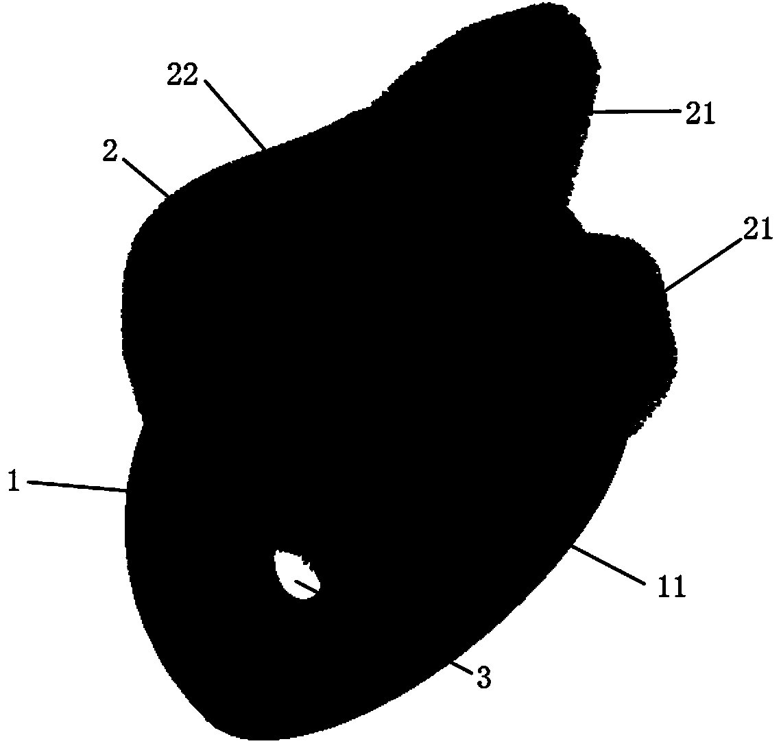 Personalized acetabulum based on 3D (three-dimensional) printing and intraosseous support prosthesis, operation guide plate matched with support prosthesis, and preparation method