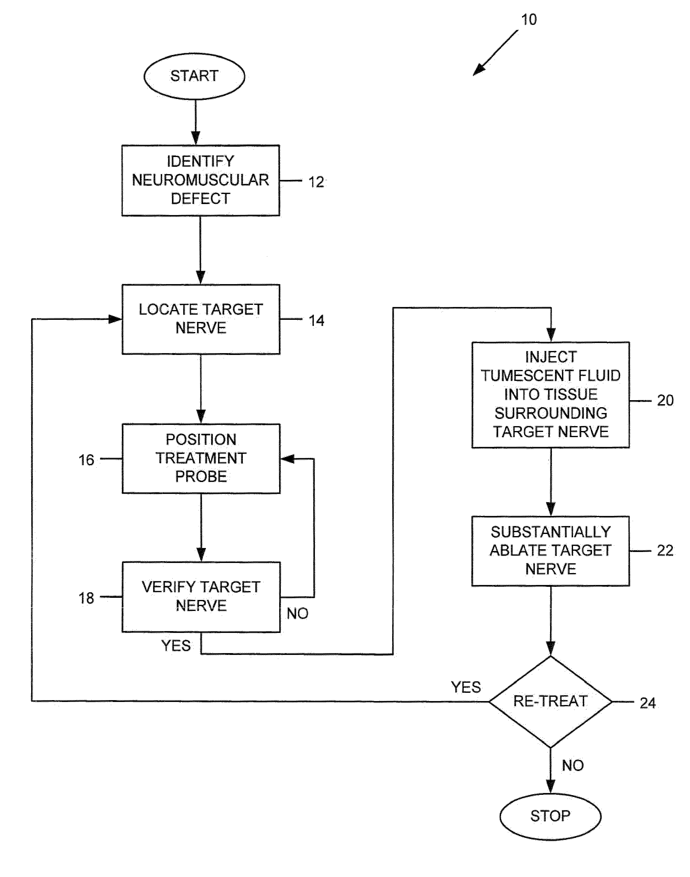 Apparatus and method for treating a neuromuscular defect