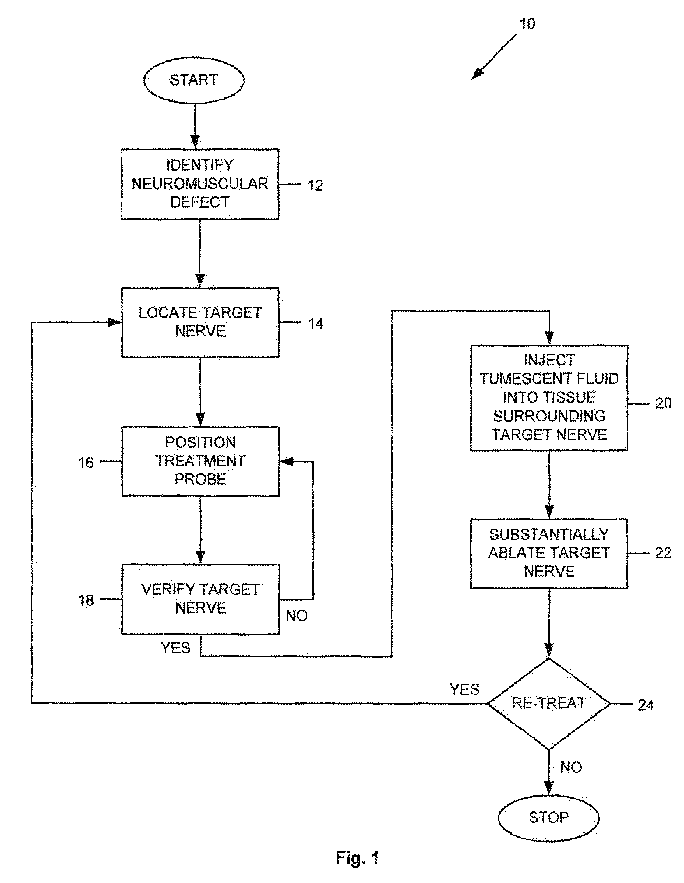 Apparatus and method for treating a neuromuscular defect