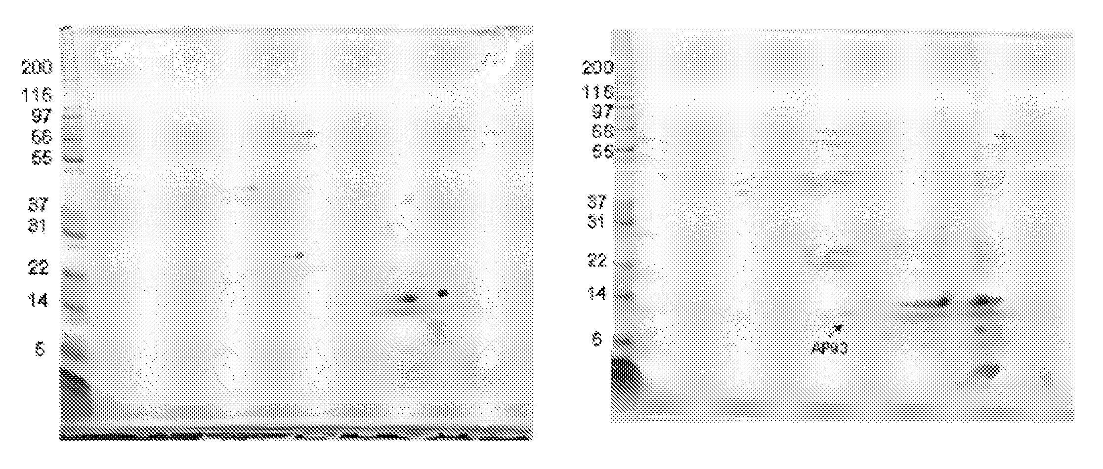 Methods and devices for diagnosis of appendicitis