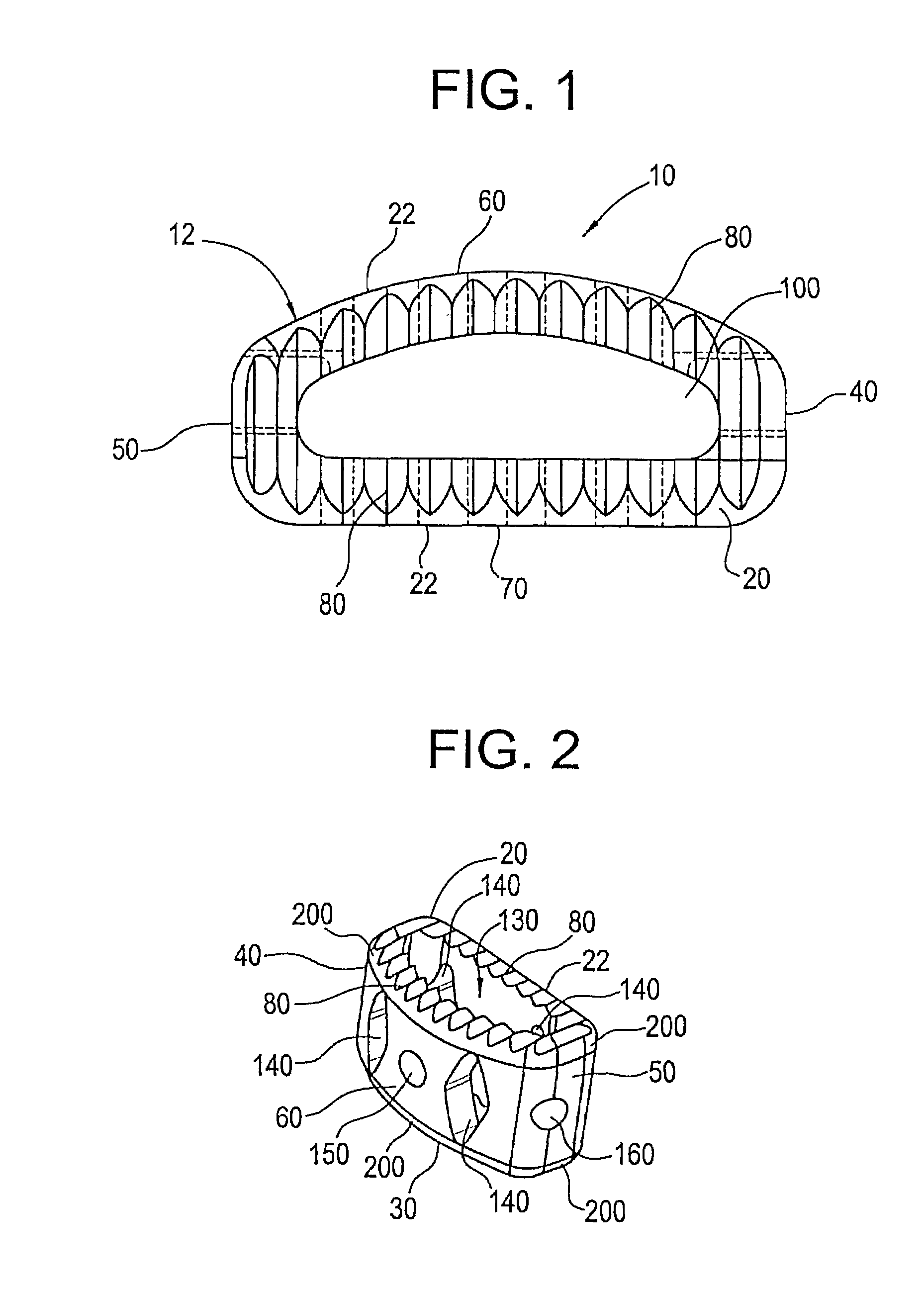 Spinal fusion implant