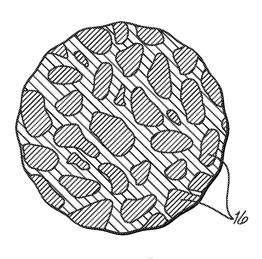 Medical implant formed from porous metal and method