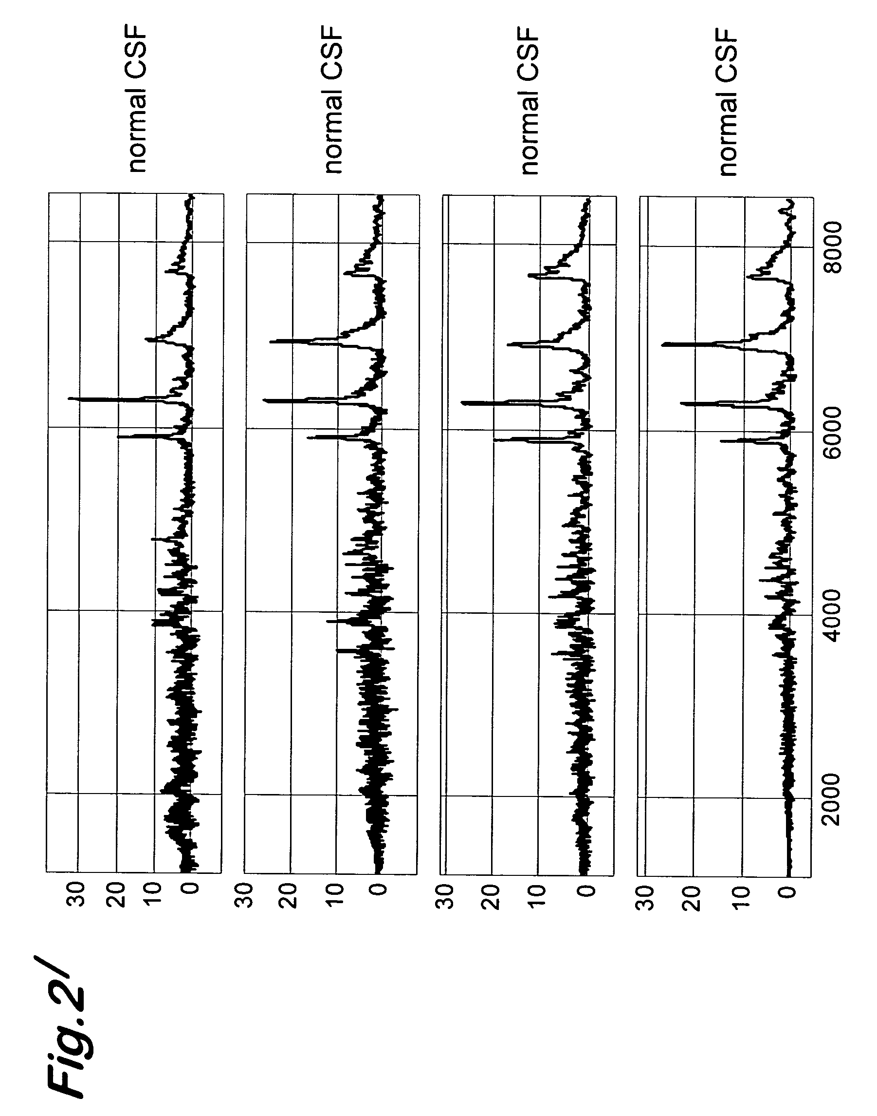 Diagnostic method for transmissible spongiform encephalopathies