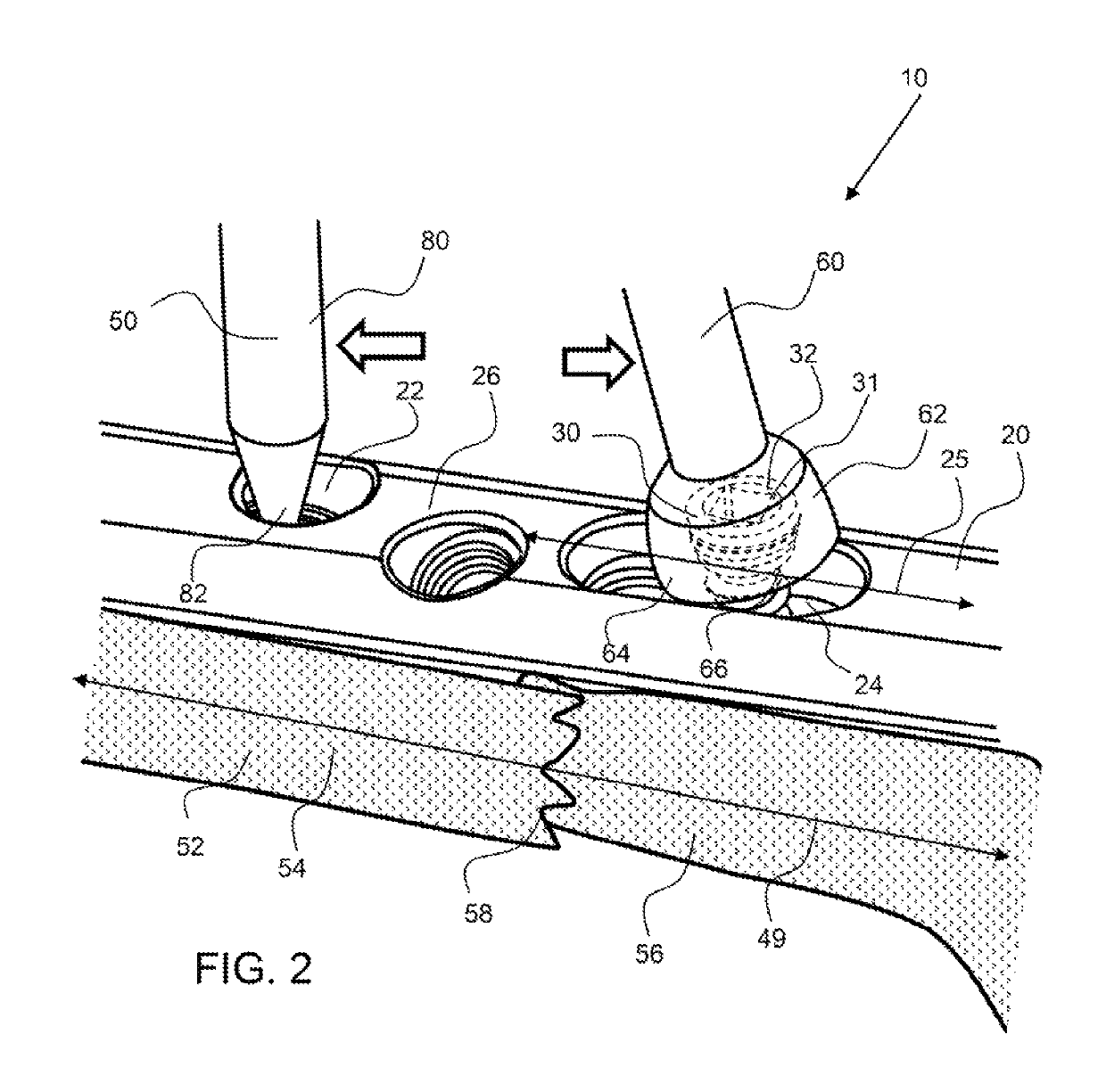 Bone manipulator system and method