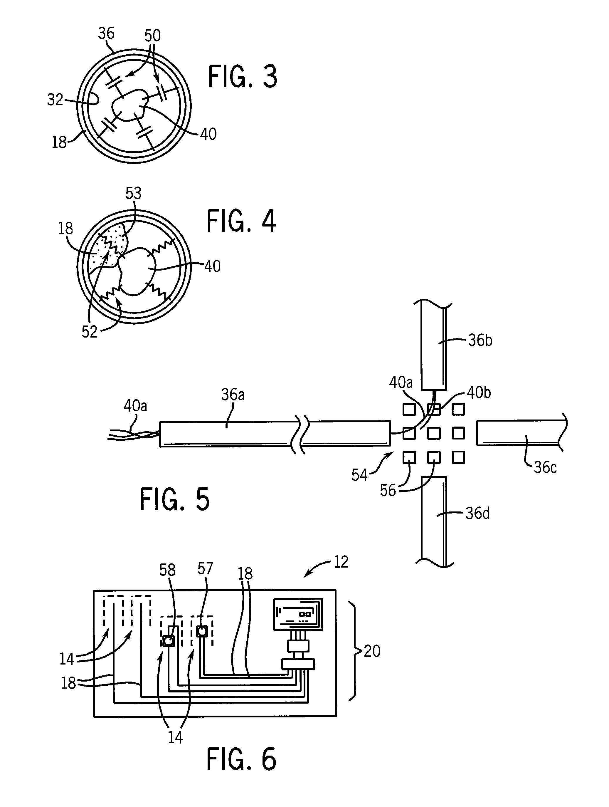 Tubular scaffold for neural growth