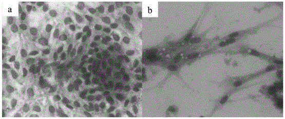 Method for in-vitro isolated culture of chicken fallopian tube epithelial cells