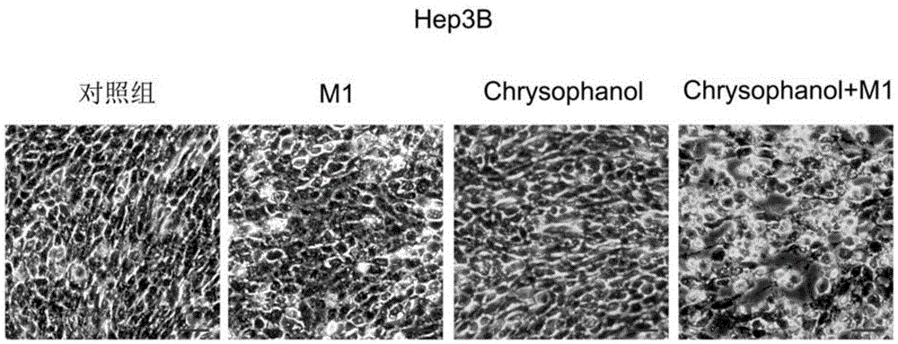 Applications of chrysophanol or derivative thereof and oncolytic virus in preparation of antitumor drugs