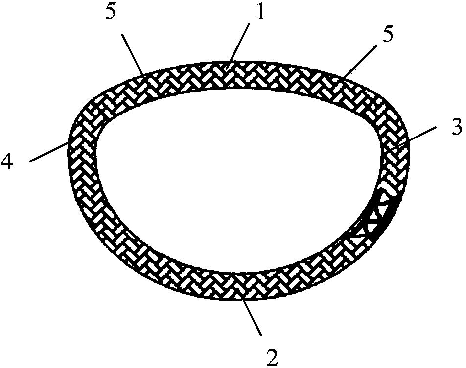 Artificial heart valve annuloplastic ring