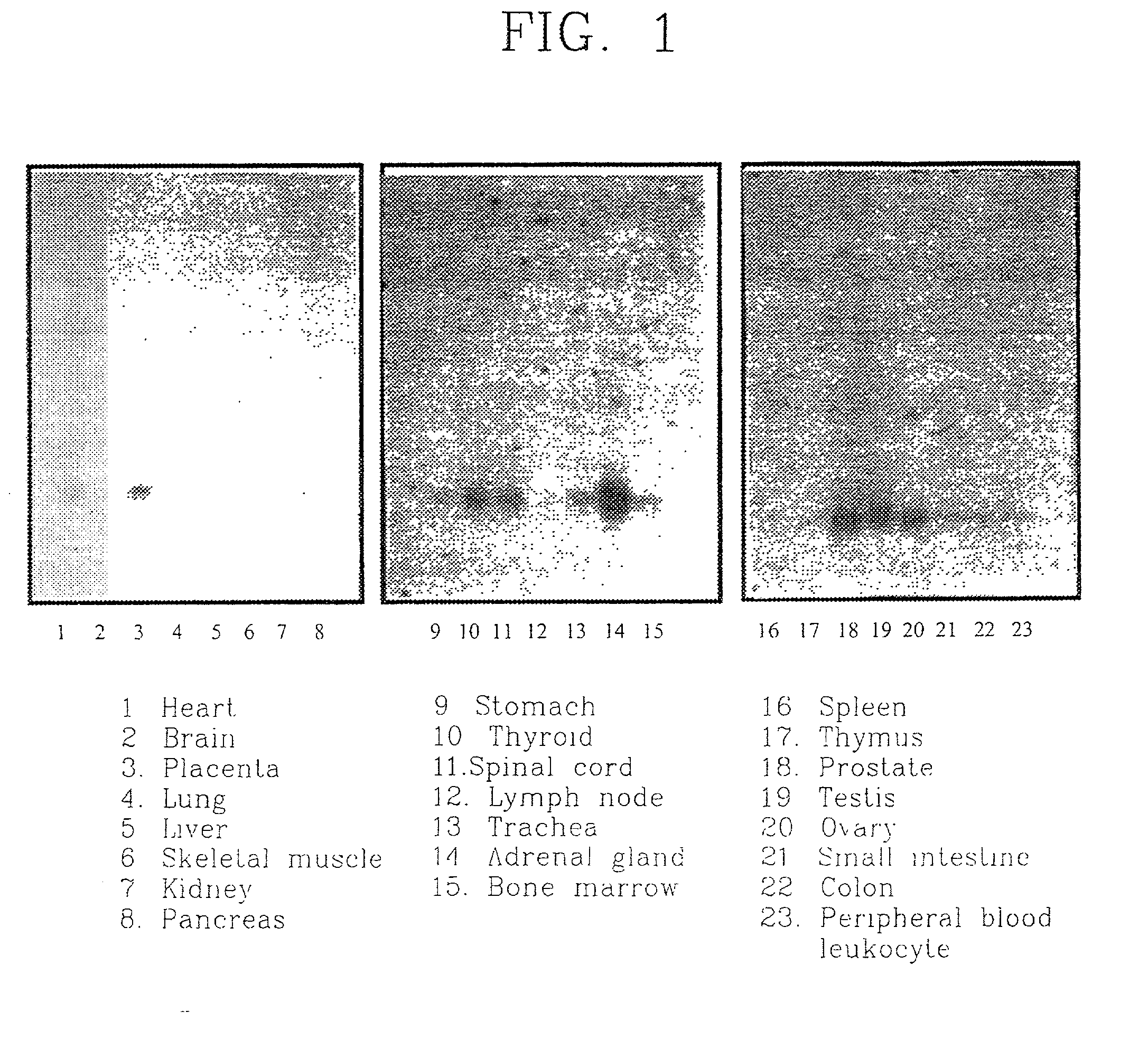 Cancer diagnosis method using cell growth inhibiting and cell differentiation specific SYG972 gene and genomic DNA and promoter thereof