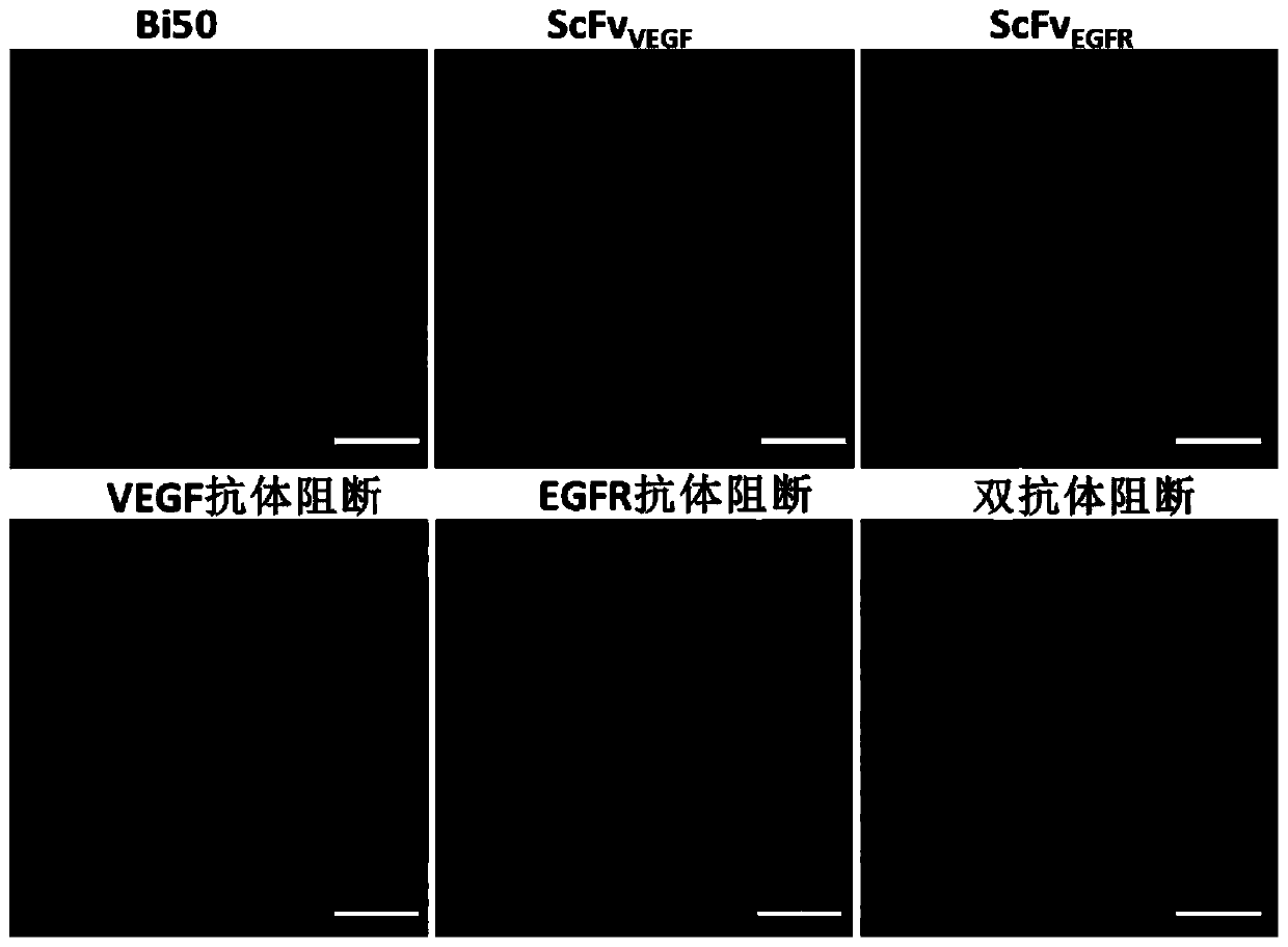 Bifunctional fusion protein targeting VEGF and EGFR and application of bifunctional fusion protein