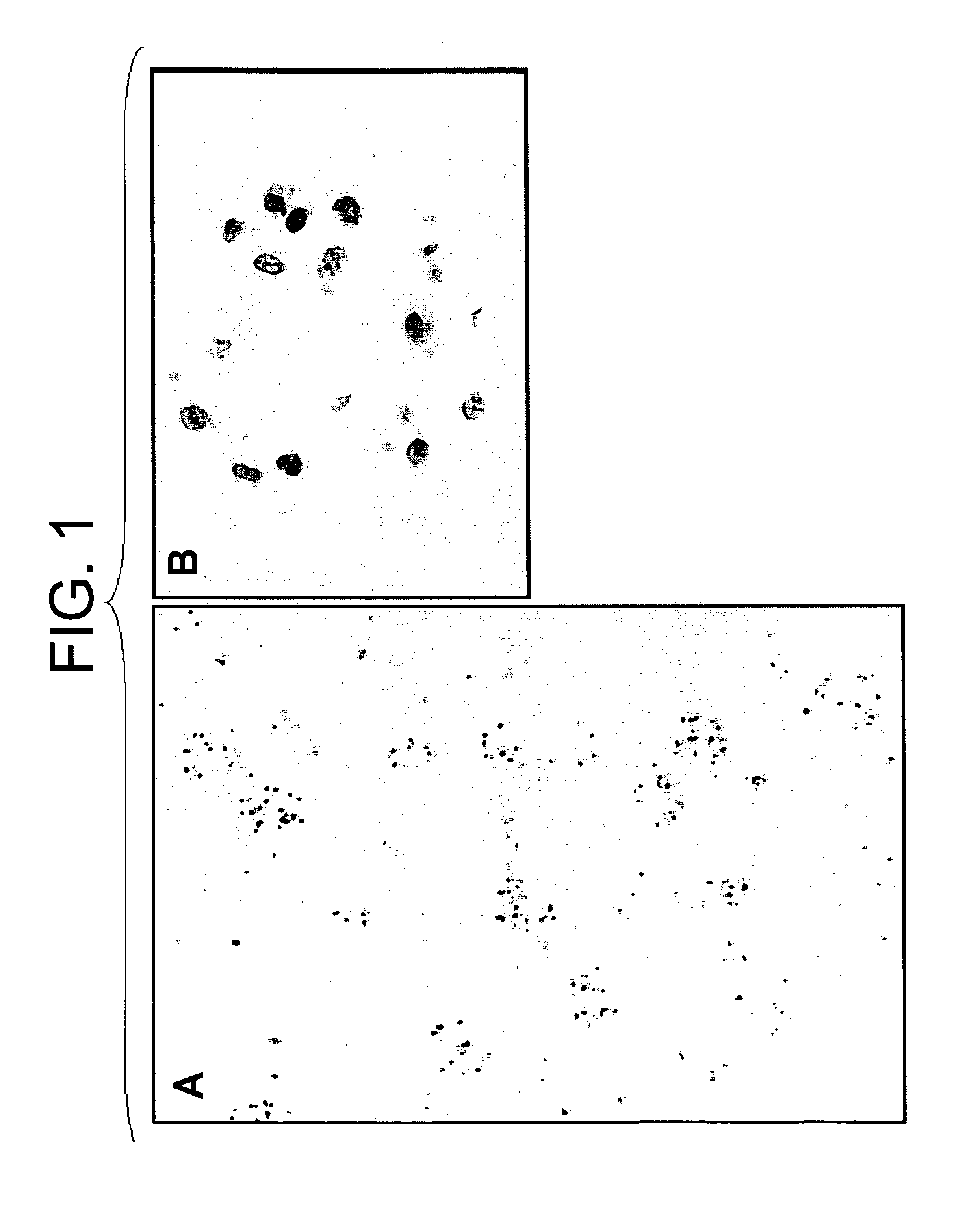 Method of gene transfer via vascular system or ureter