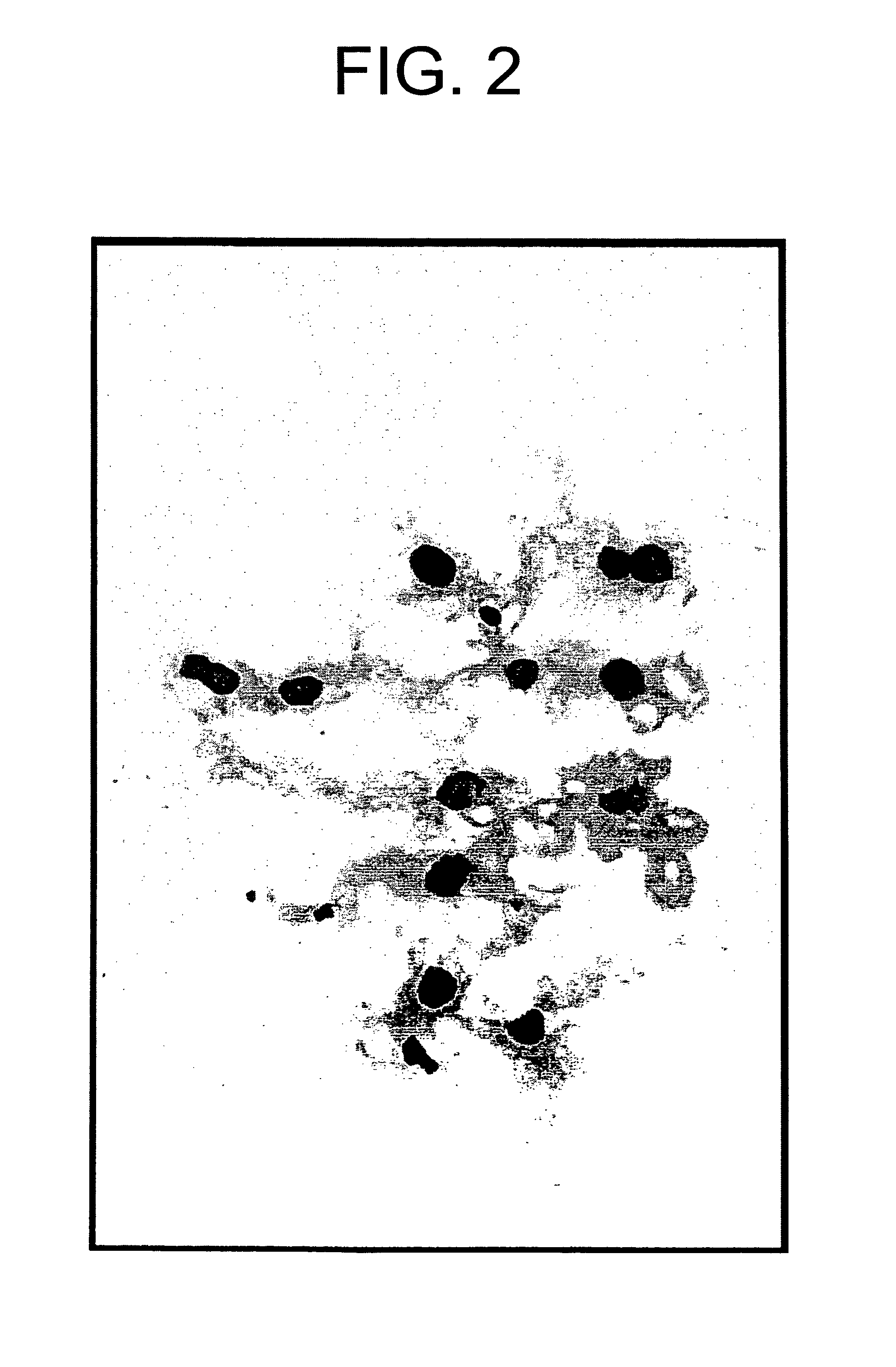 Method of gene transfer via vascular system or ureter