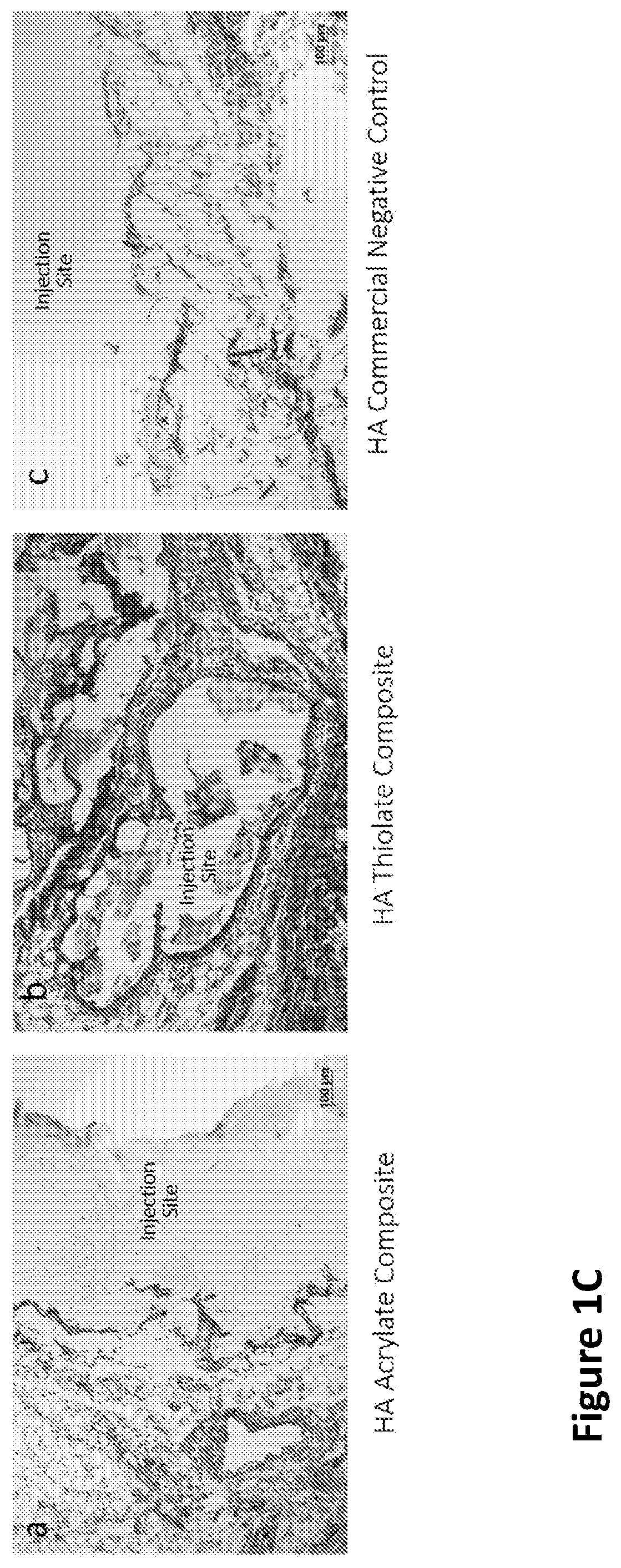 Nanofiber-hydrogel composites for enhanced soft tissue replacement and regeneration