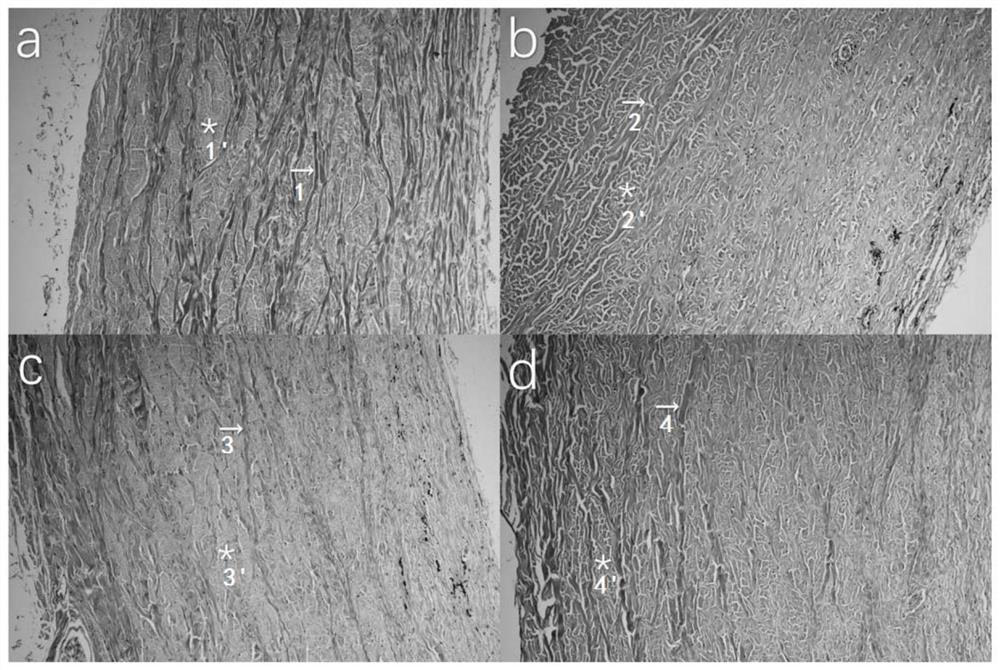 Application of transglutaminase in medicine for inhibiting or delaying myopia