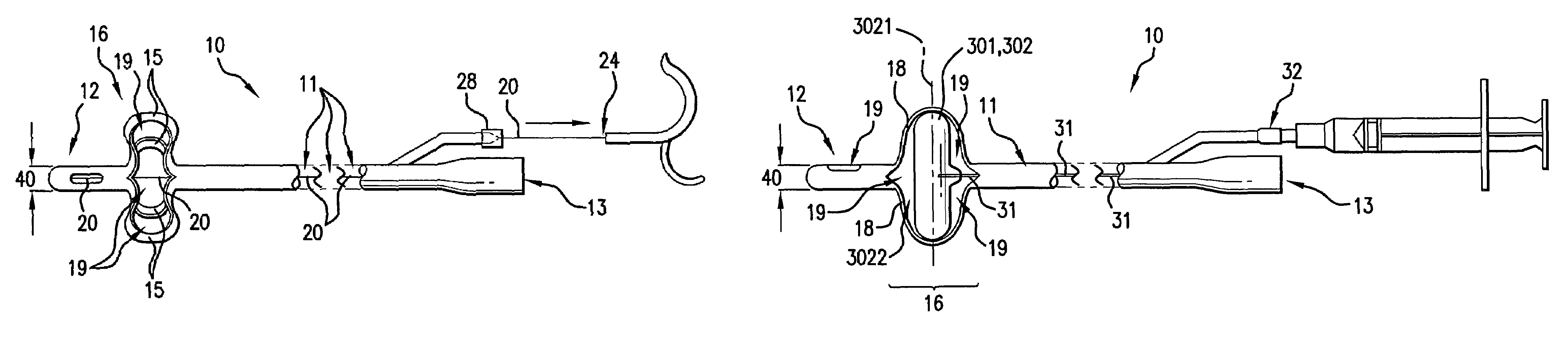 Indwelling urinary catheter