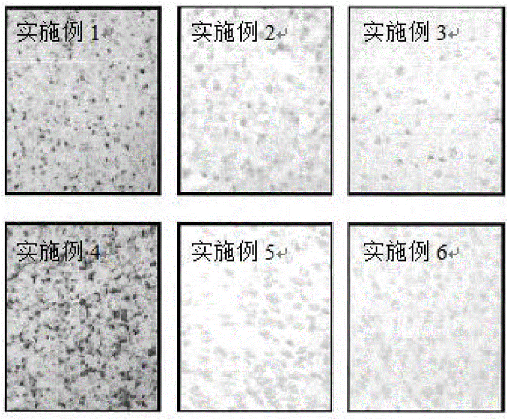 Resurrection hormone composition capable of improving filling fat survival rate and reducing fat fibration and calcification