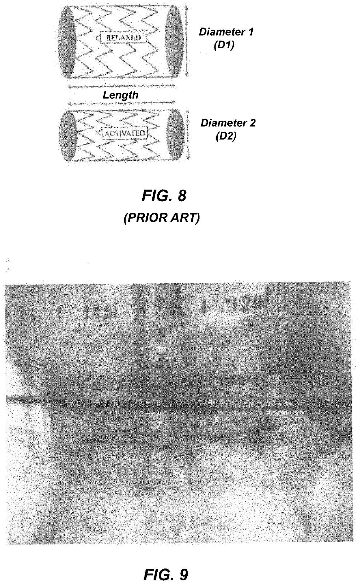 Circulatory assist pump