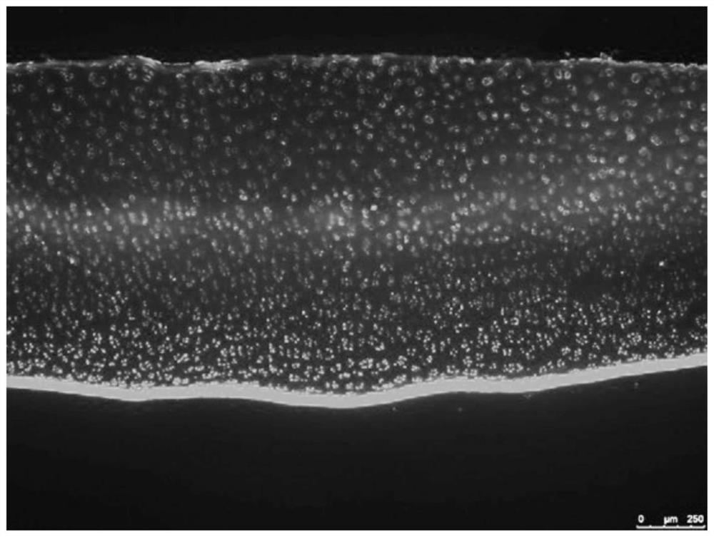 Kartogenin cartilage delivery material based on epsilon-polylysine as well as preparation method and kit thereof