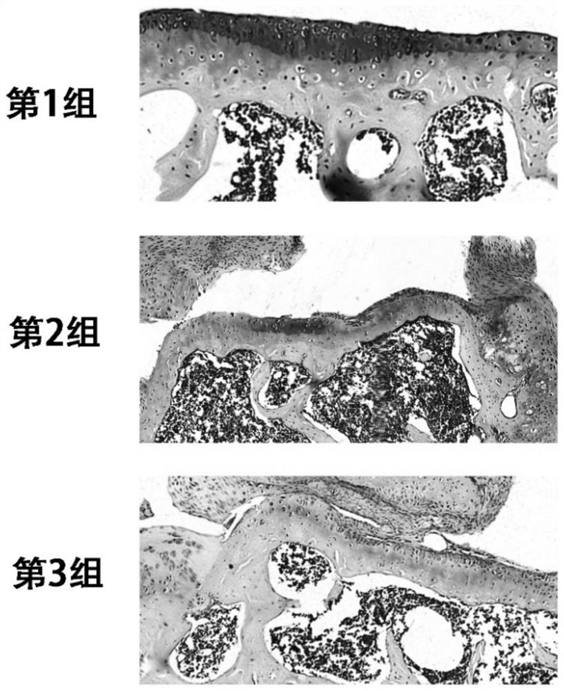 Kartogenin cartilage delivery material based on epsilon-polylysine as well as preparation method and kit thereof