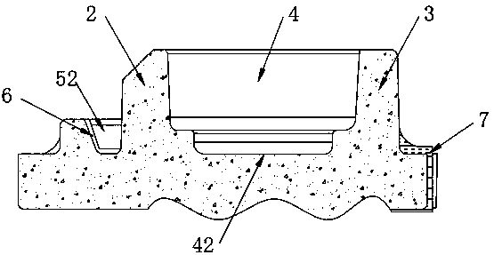 Process method and optimized structure for eliminating shrinkage porosity of side cover of valve body of steering gear