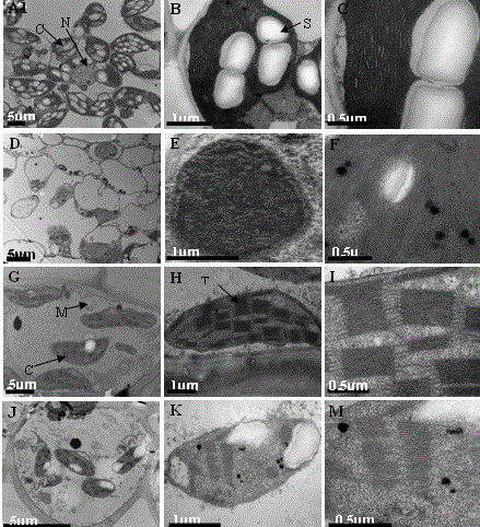 A protein regulating chloroplast development and its gene and application