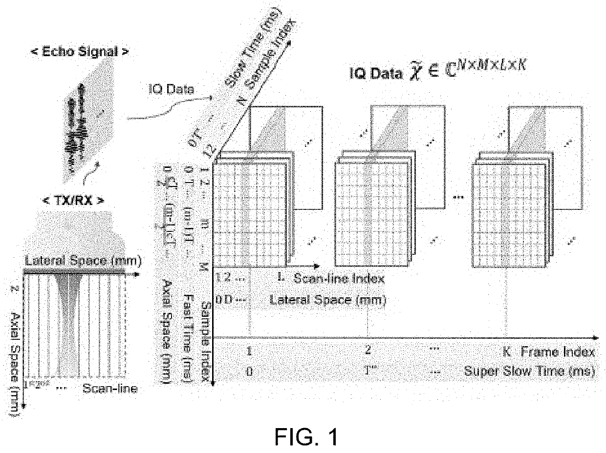 Ultrasonic imaging with clutter filtering for perfusion