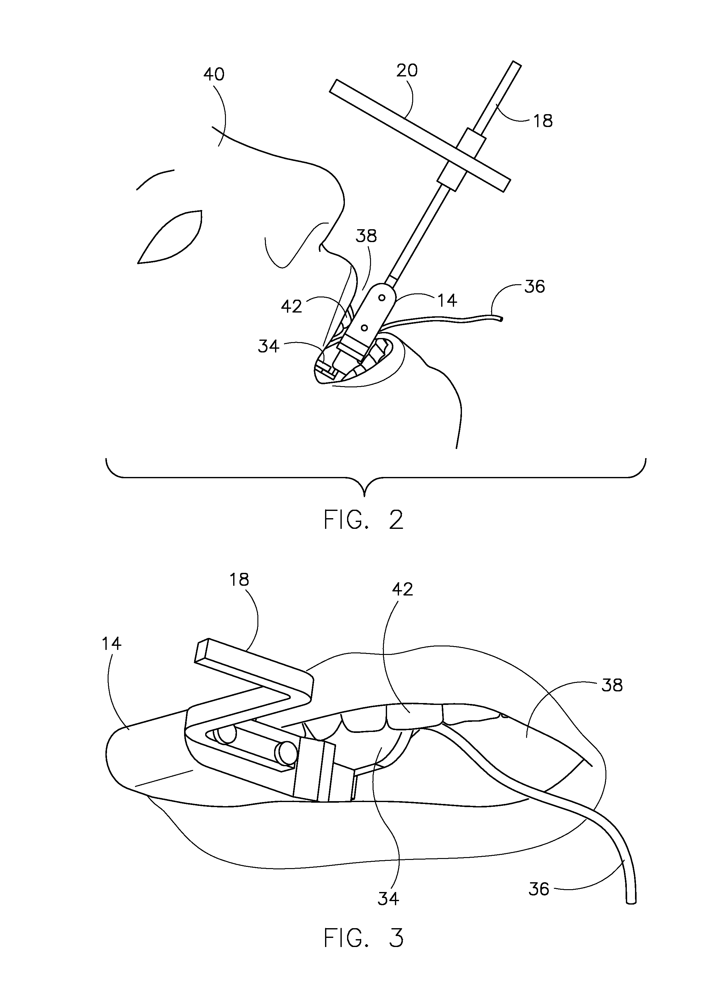 Apparatus for holding digital dental x-ray sensor and method of making same