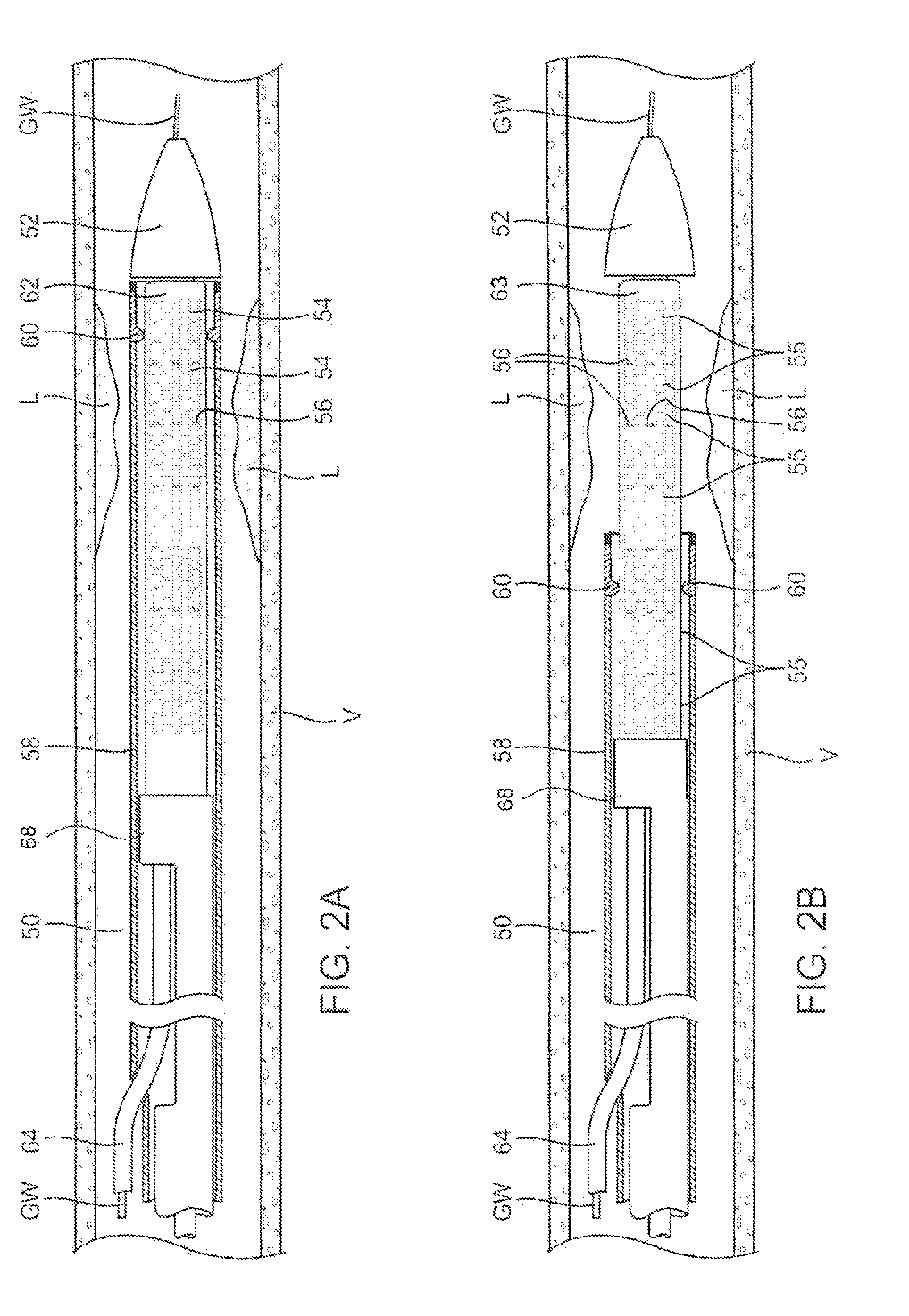 Adjustable-length drug delivery balloon