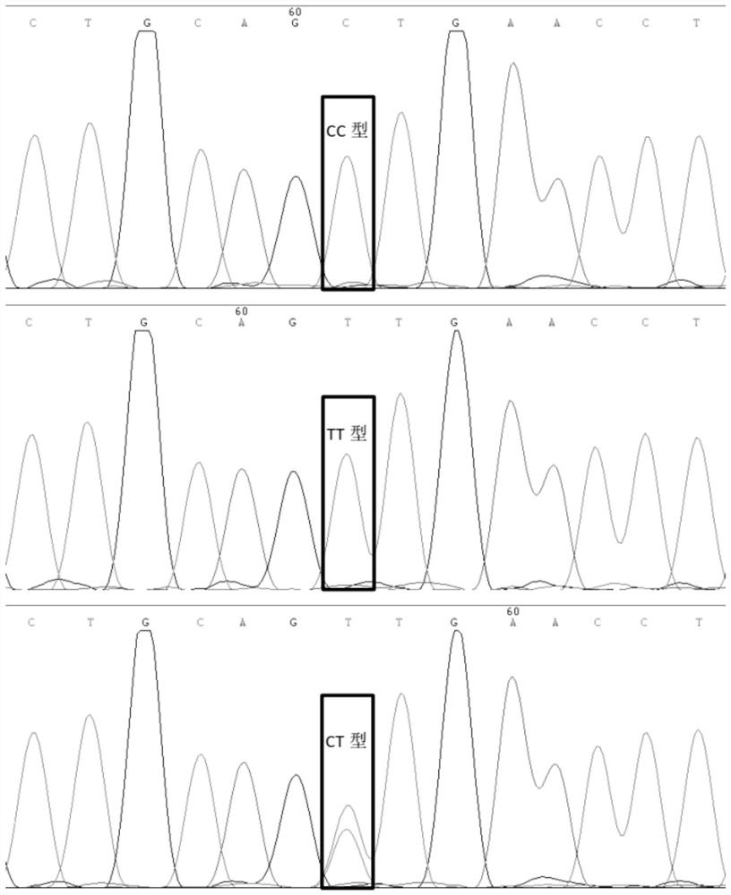 SNP marker related to Sujiang pig production traits and preparation method and application thereof