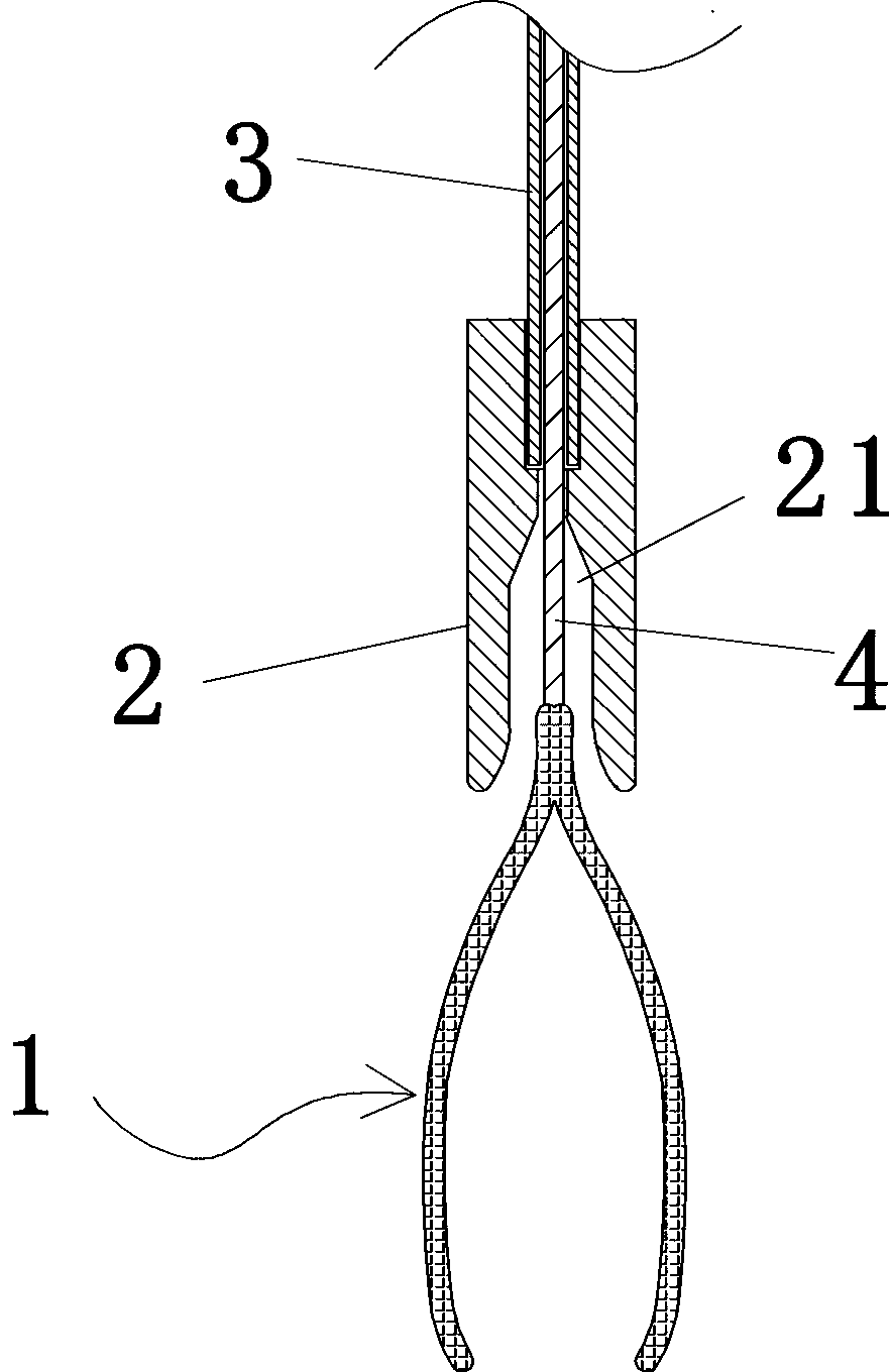 Abdominal minimally invasive surgery clamp