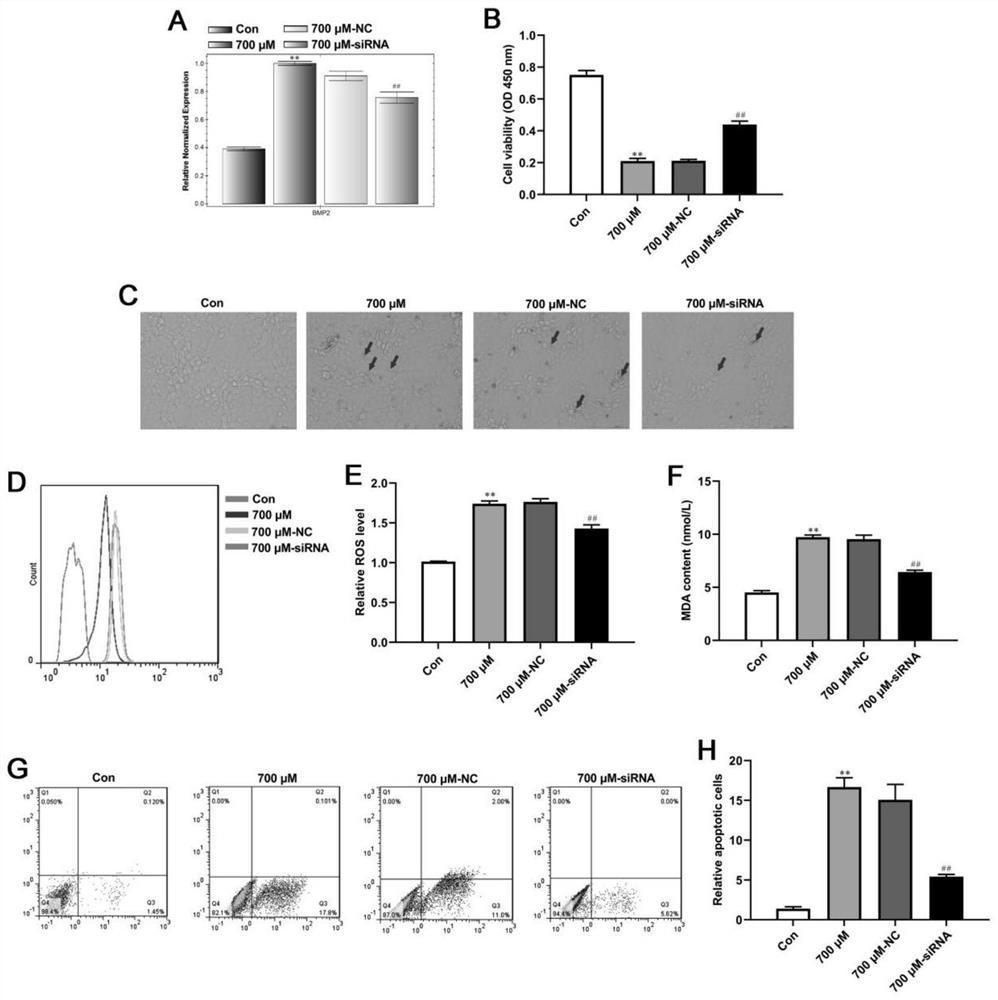 Application of mechanism of BMP2 silencing in elimination of renal calcium oxalate calculus injuries