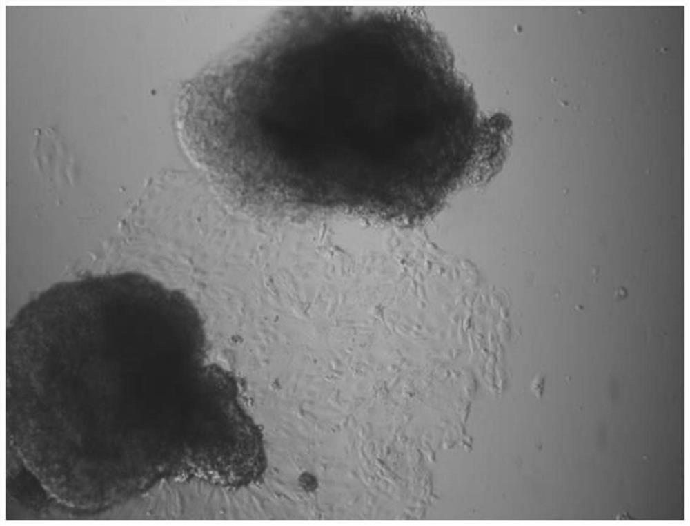 Method for obtaining sheep endometrial epithelial cells and stroma cells, separation and purification method and application