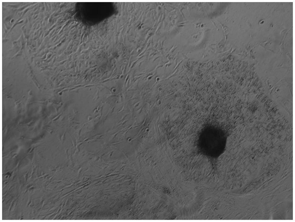 Method for obtaining sheep endometrial epithelial cells and stroma cells, separation and purification method and application