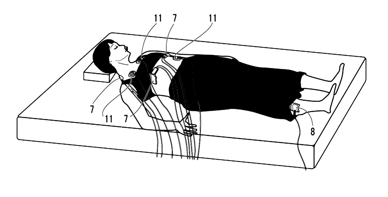 Device for measurement and evaluation of cardiac function on the basis of thoracic impedance