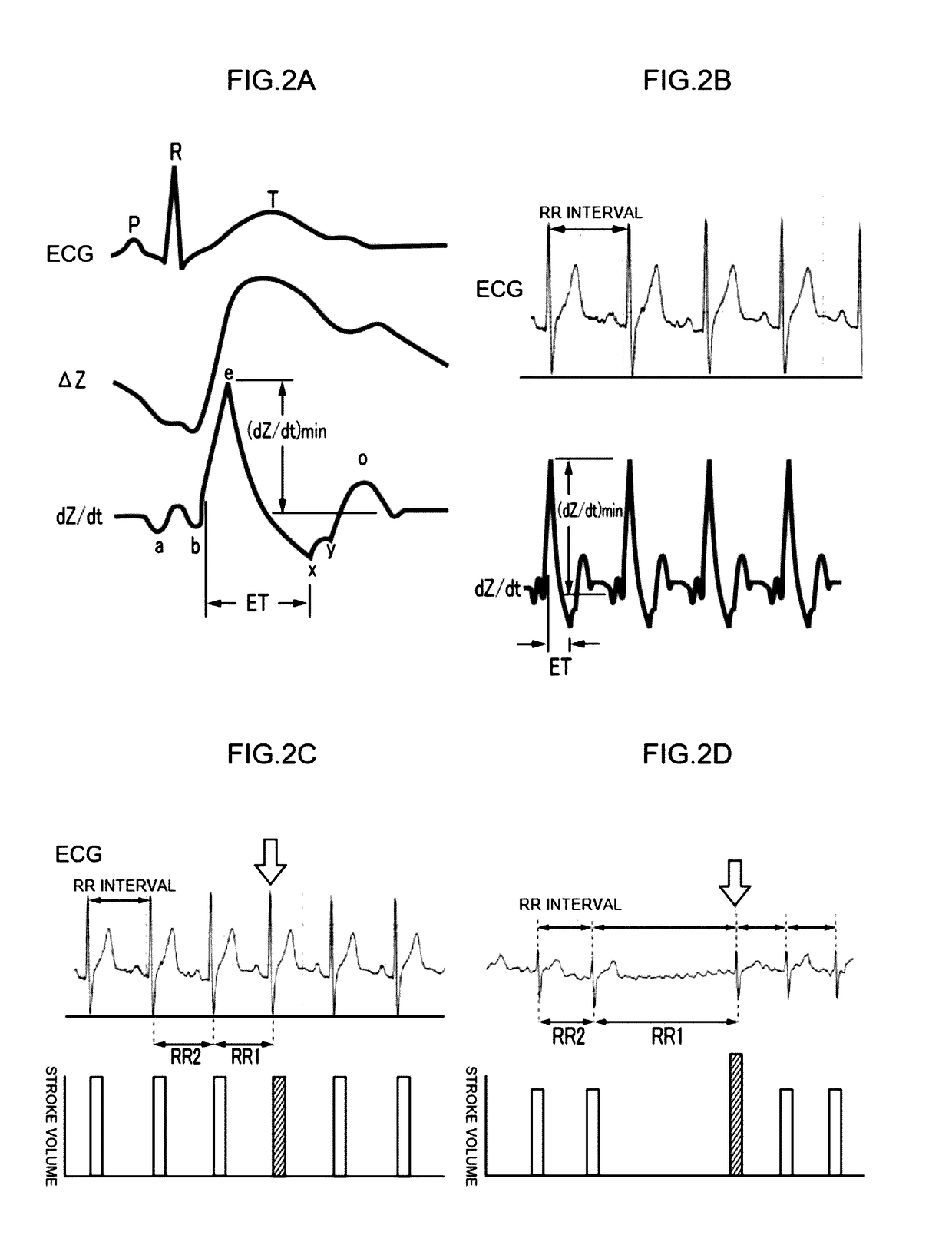 Device for measurement and evaluation of cardiac function on the basis of thoracic impedance