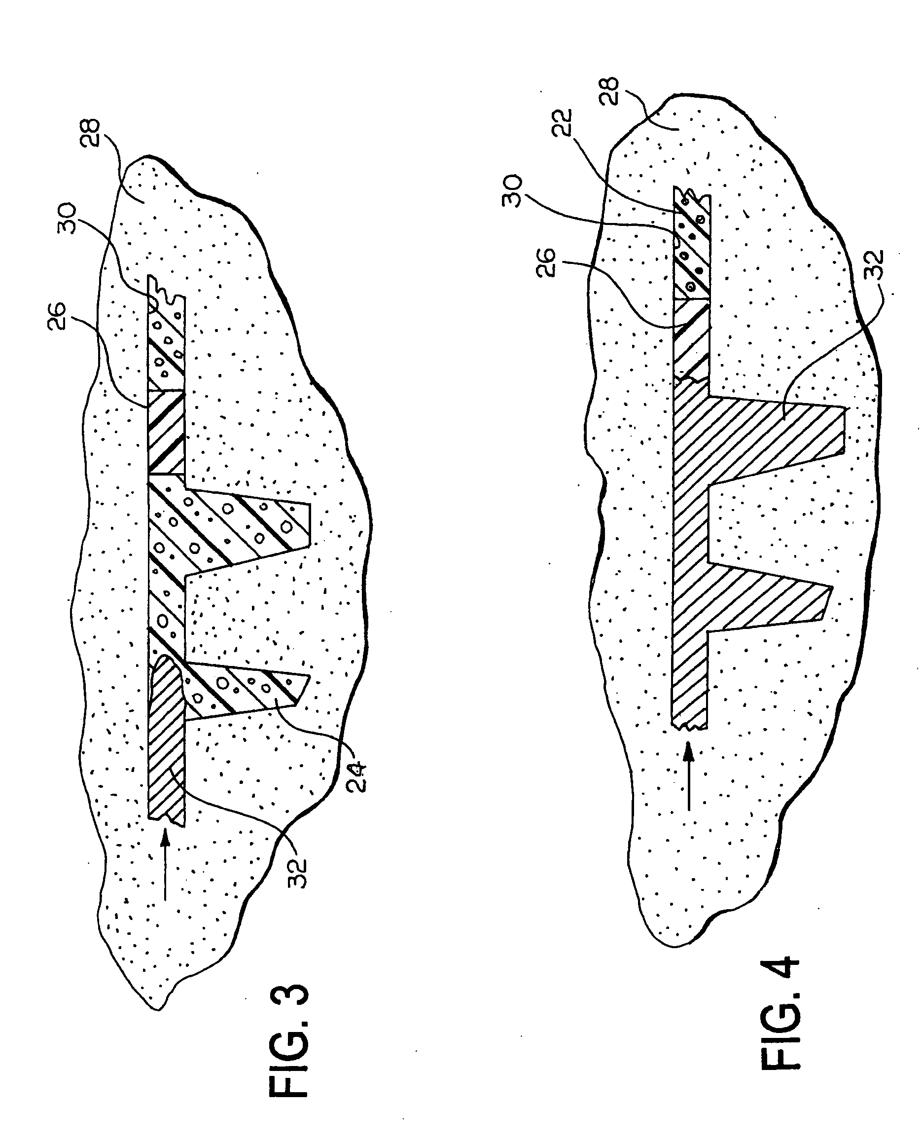 Method and apparatus for controlling dispersion of molten metal in a mold cavity