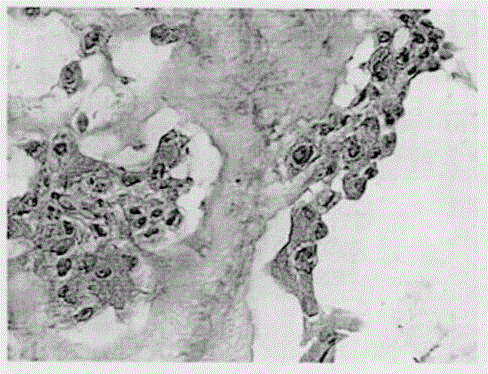 Three-dimensional cell culture medium for anti-tumor drug screening system and preparation of three-dimensional cell culture medium