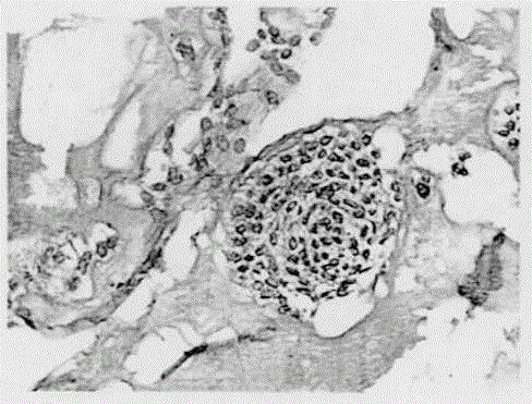 Three-dimensional cell culture medium for anti-tumor drug screening system and preparation of three-dimensional cell culture medium