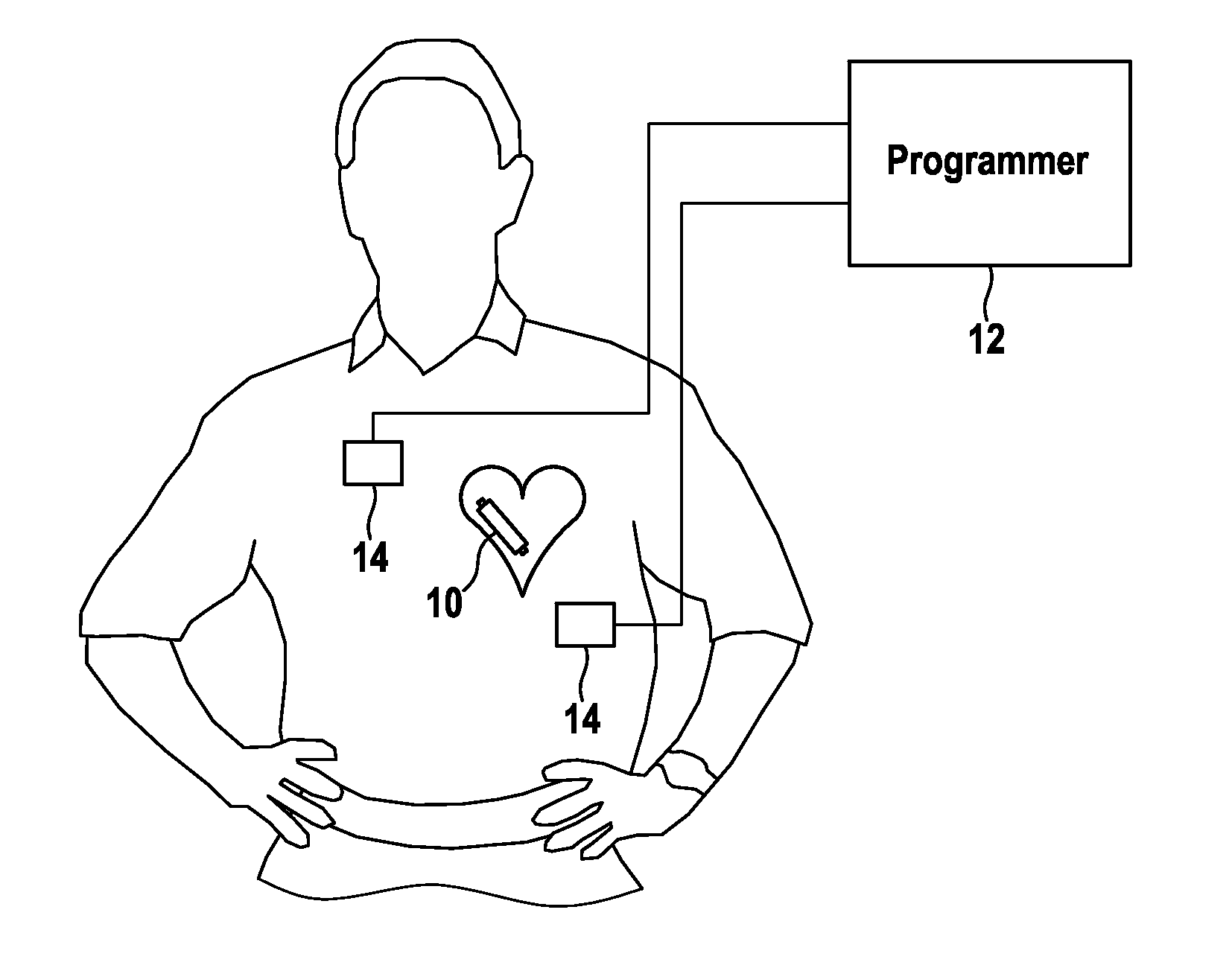 Implantable medical device, medical system and method for data communication