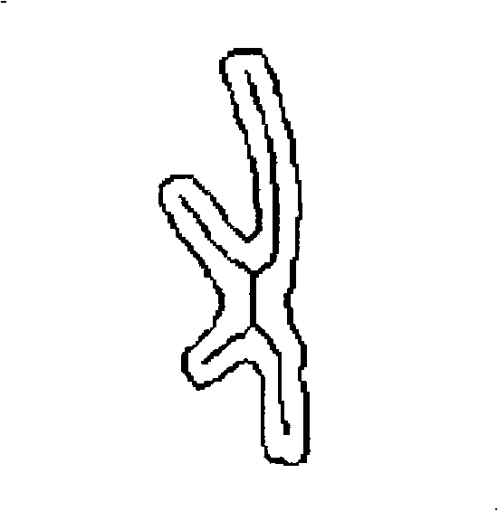 Automatic separating method for X type overlapping and adhering chromosome